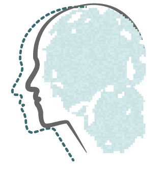 États limites ou borderline